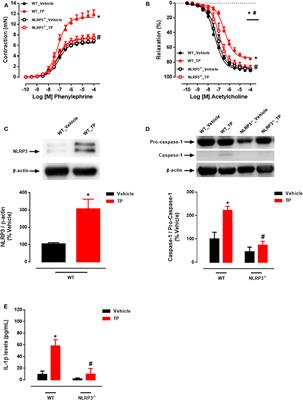 Supraphysiological Levels of Testosterone Induce Vascular Dysfunction via Activation of the NLRP3 Inflammasome